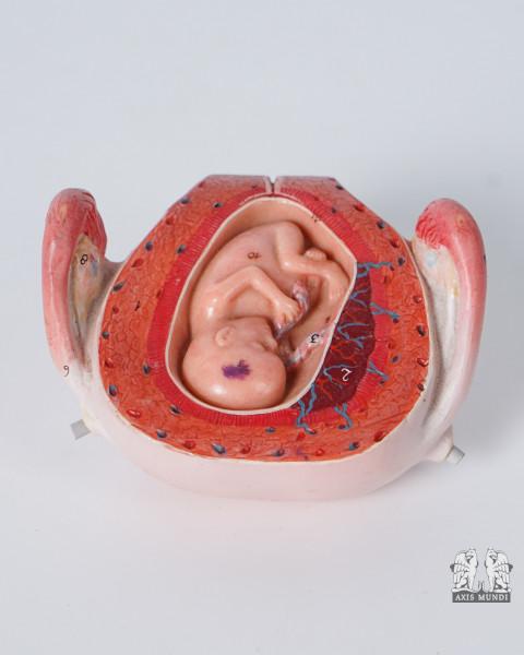 Anatomie-Modell Uterus